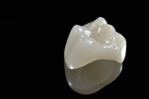 Dental Crown Replacement in Merced